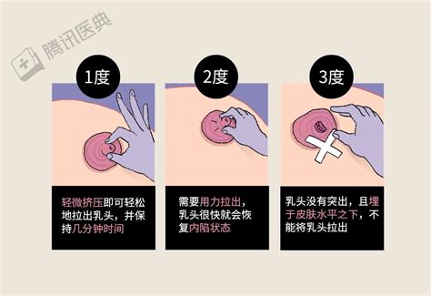 女人的乳頭|乳暈上有「小顆粒」正常嗎？乳暈顏色和別人不一樣？女孩到女人。